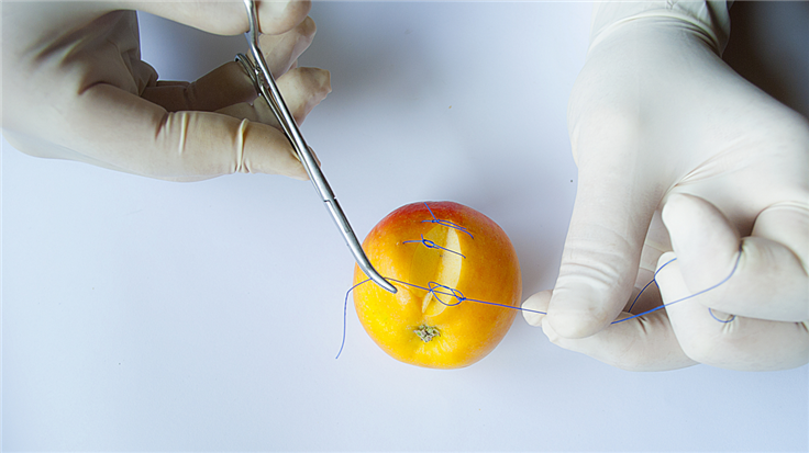 hands in surgical gloves stitching a damaged apple